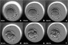 Time-lapse embryo development in IVF