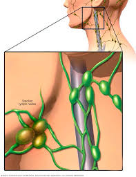 Lymph node dissections, or lymphadenectomies, are surgical procedures that play an important role in cancer treatments. Swollen Lymph Nodes Symptoms And Causes Mayo Clinic