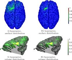 Get direct access to itu through official links provided below. Zeffiro User Interface For Electromagnetic Brain Imaging A Gpu Accelerated Fem Tool For Forward And Inverse Computations In Matlab Springerlink