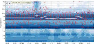 Monarch: Google's Planet-Scale In-Memory Time Series Database
