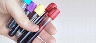 STD Testing Centers Marion, AR