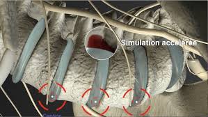 Pin On Herniated Disc