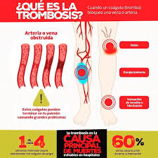 Los coágulos de sangre se forman cuando la tendencia de la sangre a coagularse aumenta. Facebook