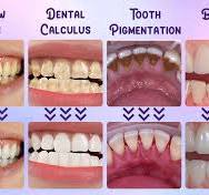 Amazon.com : Purple Teeth Restoration Mineral Powder,Mineral ...