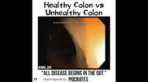 Although the colon and the semicolon look similar, they each have very different uses in the english language. Healthy Colon Vs Unhealthy Colon Youtube