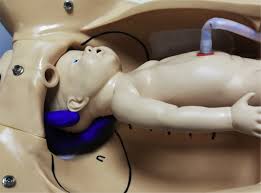 Image result for Manual Rotation in Occipitoposterior Presentation