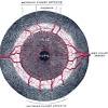 You may have other symptoms of a stroke, such as weakness on one side of your body or the inability to speak. 1