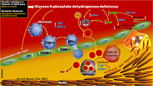 Image result for G6PD Deficiency
