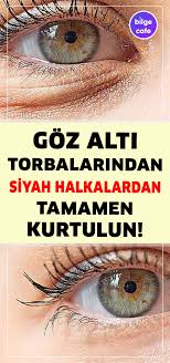 Goz Alti Torbalarindan Siyah Halkalardan Ve Kirisikliklardan Bu Dogal Yontemle Kurtulun Dogal Cilt Bakimi Dogal Dogal Cilt