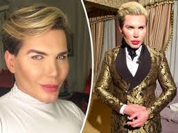 Alves had earlier said that he plans to transform himself into a woman by another series of surgeries; The Human Ken Doll Rodrigo Alves Admits How He Can Afford 400 000 Surgery Bill Daily Star
