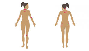 Fibromyalgia Symptoms In Women Causes And Treatments