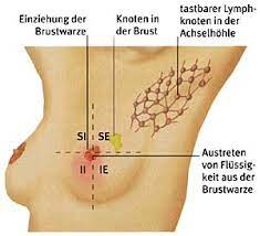 Brustkrebs Ratgeber Praxis Margareten