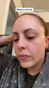 The Lady That Died from Wrasp Nest in Her Hair