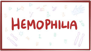 It's also a disease that's been prevalent in european royal families. Haemophilia Haemophilia Scotland