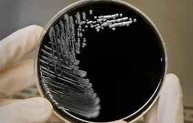 Then it was an unknown mystery disease which caused many. Cdc Training Center Warn Of Potential Legionella Bacteria In Low Or No Occupancy Workplaces 2020 10 15 Safety Health Magazine