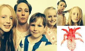 But chances are it won't work all that well. Mum Uses Hair Straighteners To Kill Her Children S Head Lice And Nits Daily Mail Online