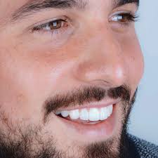 SONRíE 🤩 Gracias gracias gracias al @dr.roberto.otero y a todo el equipo  de @fazionitopdentistry por todo este proceso… Super contento con mi nueva  sonrisa 😁!