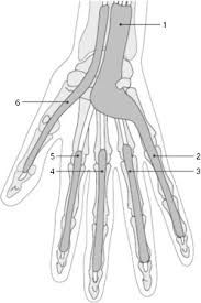 Image result for phlegmon of hand)