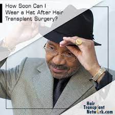 How Soon Can I Wear A Hat After Hair Transplant Surgery Hair Transplant Surgery Hair Transplant Hair Loss Women
