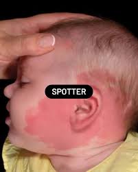 Photos by Simply PediaTricks by Dr Aditya Bhatt (@draditya_bhatt) ·  December 19, 2024