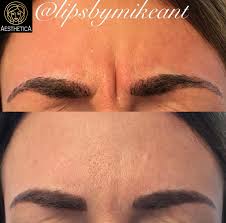 Cancellations · botox's profile picture. Botox Before After Aesthetica Swansea Facial Aesthetics