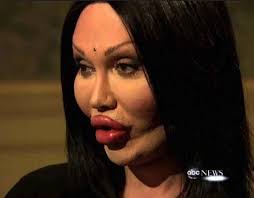 Desastres titânicos da cirurgia plástica