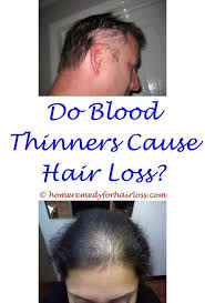 However, with the recent atrial fibrillation guidelines, the newer anticoagulants are preferred in the majority of situations. Pin On Hair Loss