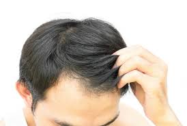 Biotin is a vitamin that is used often to regrow hair. How Do I Thicken My Hair Thriftyfun