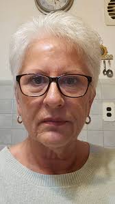 What hair style suits a 62 year old woman with silver hair and thinning  regrowth?
