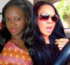 Black And White Bleaching Cream Results Pin On Skin Bleaching