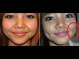 How To Get Dimples Naturally At Home Naturally Get Dimples Quick Youtube Dimple Piercing Face Skin Care Dimples