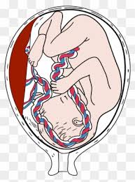 Clinical cases from the practice of an endocrinologist / t. Pregnancy Clip Art Transparent Png Clipart Images Free Download Page 4 Clipartmax