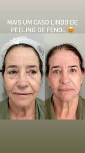 Dr Marco Antonio (@dr_marcoantonio) • Instagram photos and videos