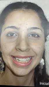 Silvino Rauber Ortodontista (@silvinorauber_mestre_orto) • Instagram  फोटोहरू र भिडियोहरू