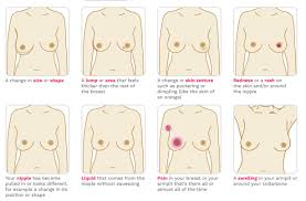 Sometimes breast cancer cells can spread to the skin. Signs Of Breast Cancer How To Check Your Breasts