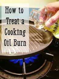 Ten Cooking Oil Burn Home Remedies And Treatments Cooking Oil Burn Burns Treatment Skin Burn Remedies
