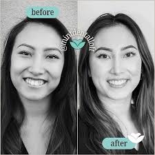 Dr. Tran Han DDS, FAGD 3DSmileBoss (@mintsmileboss) • Instagram photos and  videos