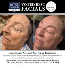 Book Online Now — Esthetics by Marlene