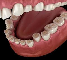 Image result for Occlusal
