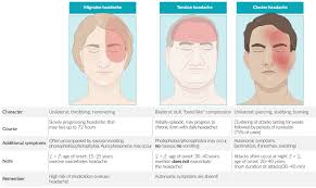 Image result for Acute Localized Headache