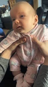 2 years ago today my sagital cranio baby said “HELLOWW” defying all odds of  any baby.. never mind a cranio baby .. at only 2 months old! Fluke or not,  ill tale it 🙃 #cranio #craniosynostosis #alderhey ...