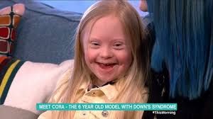 Lorraine viewers melt as Down's Syndrome boy runs riot
