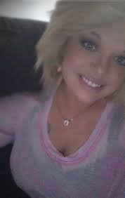 Do I still have a celebrity doppelganger after getting a unibrow scar?