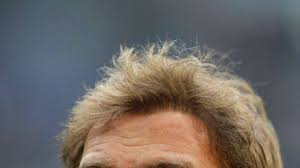 Fußballtrainer klopp und seine haare. Bvb Trainer Klopp Liess Sich Haare Transplantieren Panorama