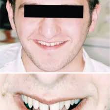 Stages in diagnosis. (Modified from Caplin.⁴⁾