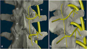 Facet Joint Syndrome From Diagnosis To Interventional Management Insights Into Imaging Full Text