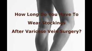 How Long Do You Have To Wear Stockings After Varicose Vein Surgery Youtube