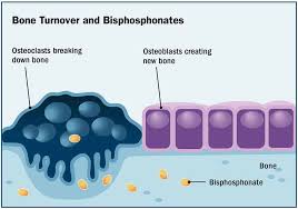 Image result for Bisphosphonates