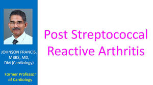 Image result for Poststreptococcal Reactive Arthritis