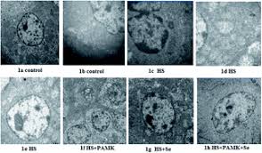 The effect of selenium and polysaccharide of Atractylodes macrocephala  Koidz. (PAMK)